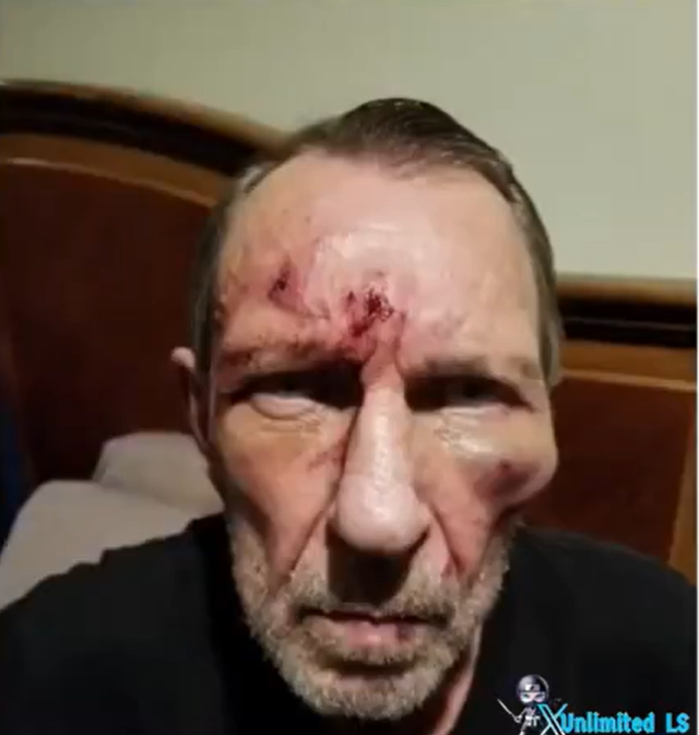 Conductor de Uber de 70 años fue brutalmente golpeado por un pasajero en Los Ángeles.