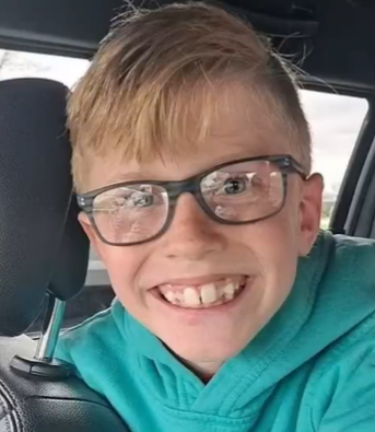 Niño de 10 años se suicida tras sufrir acoso escolar por sus gafas y dientes