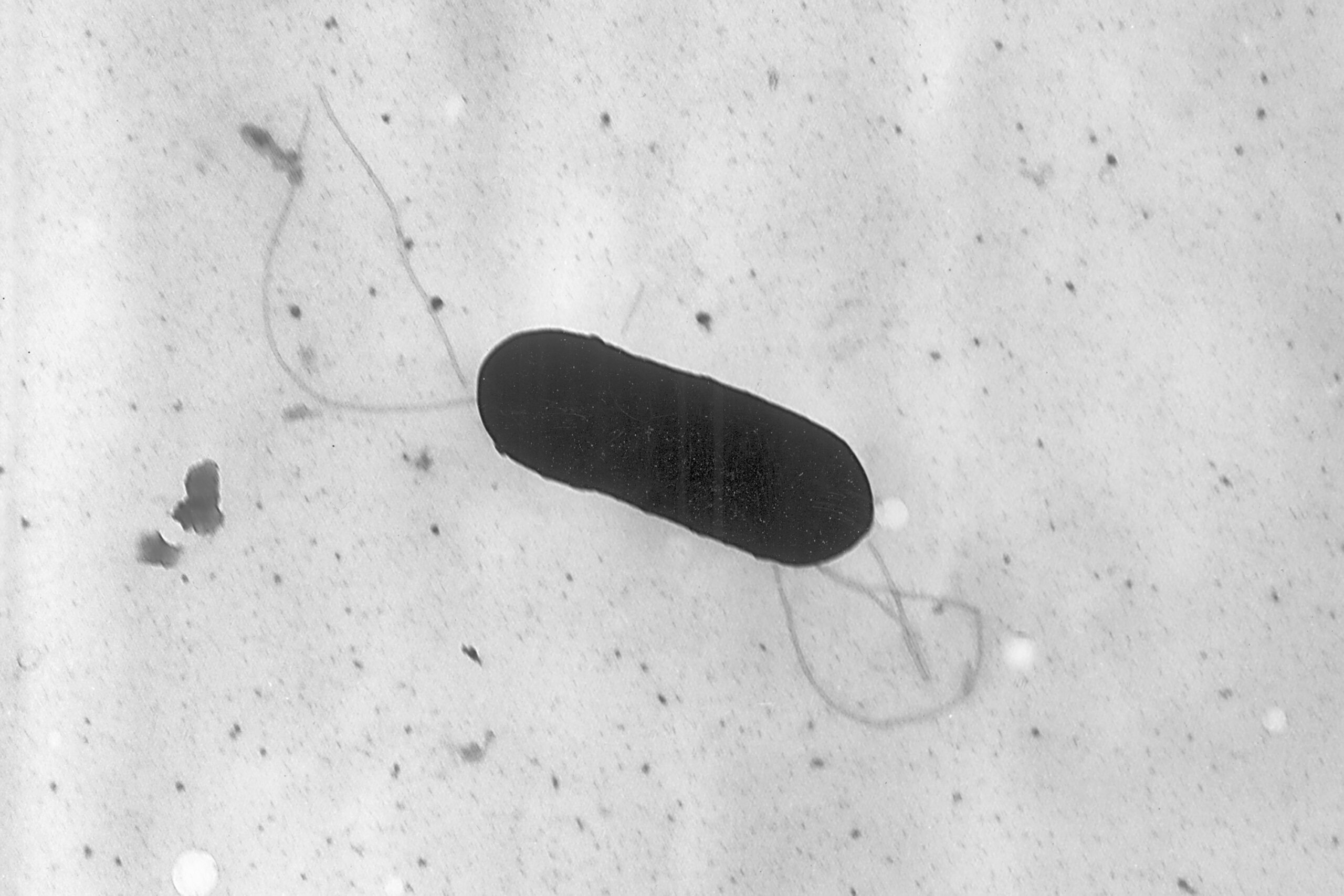 Brotes de listeria en EE.UU.: Investigaciones en curso y alerta sanitaria