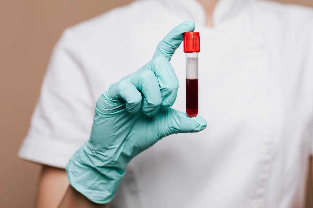 FDA aprueba primer análisis de sangre para diagnóstico de Alzheimer