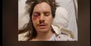 Manifestante de «No Kings Day» pierde visión en un ojo tras incidente en Los Ángeles